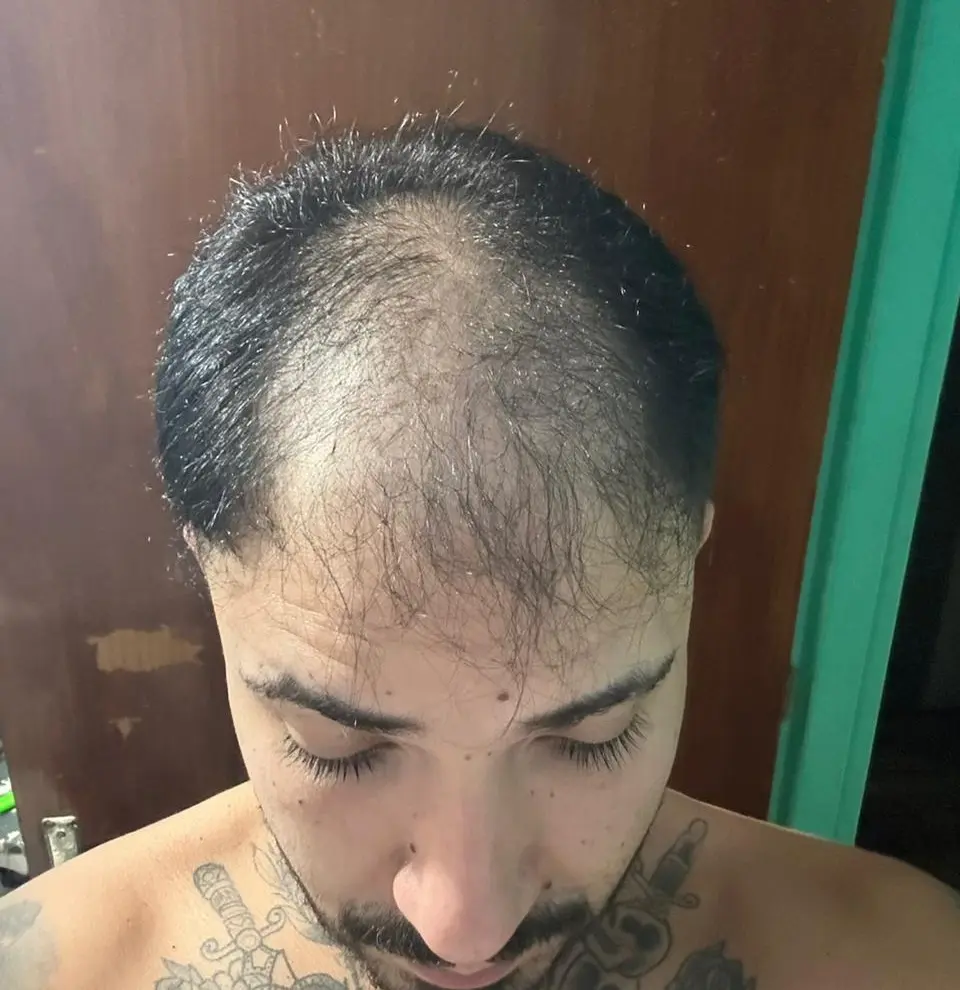 Resultado do tratamento de André S.